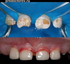 424050-stomatologiya-novodent-na-tolyatti_l.jpg